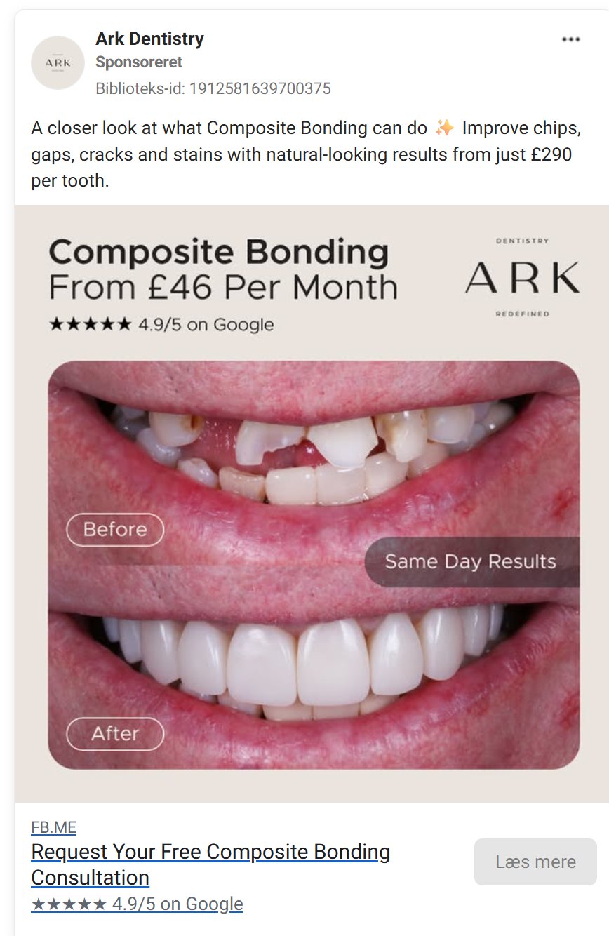 Ark Dentistry composite bonding ad
