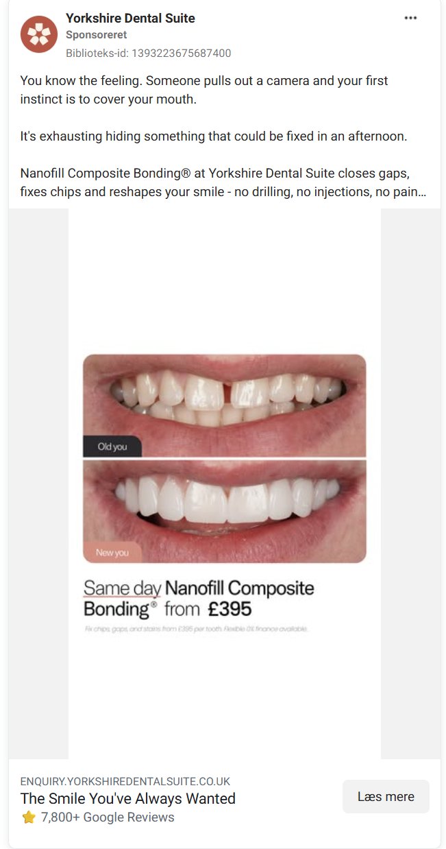 Yorkshire Dental Suite composite bonding ad